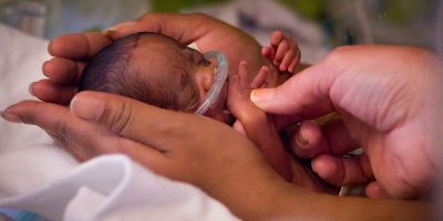 Neonatal Intensive Care Unit (NICU)
