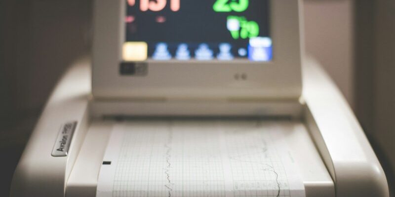 Echocardiogram (Heart Scan)