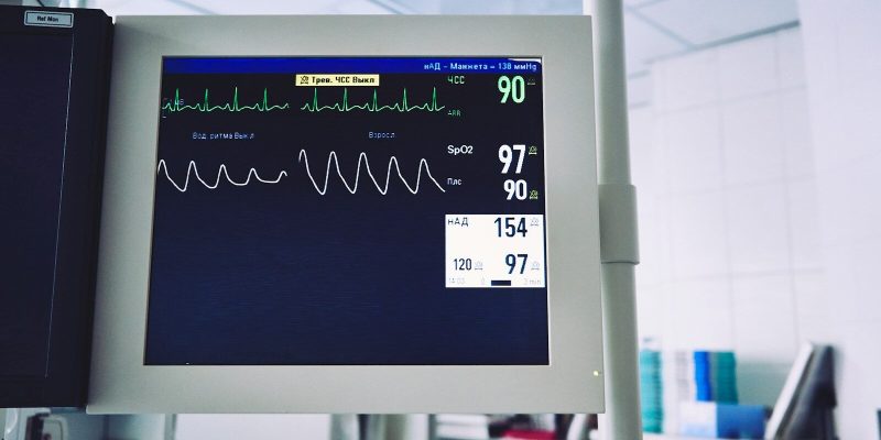 ECG (Electrocardiogram)