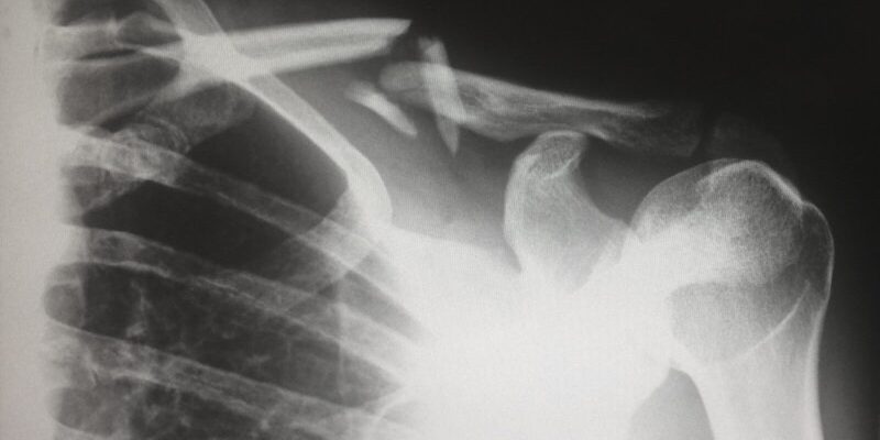 Radiodiology